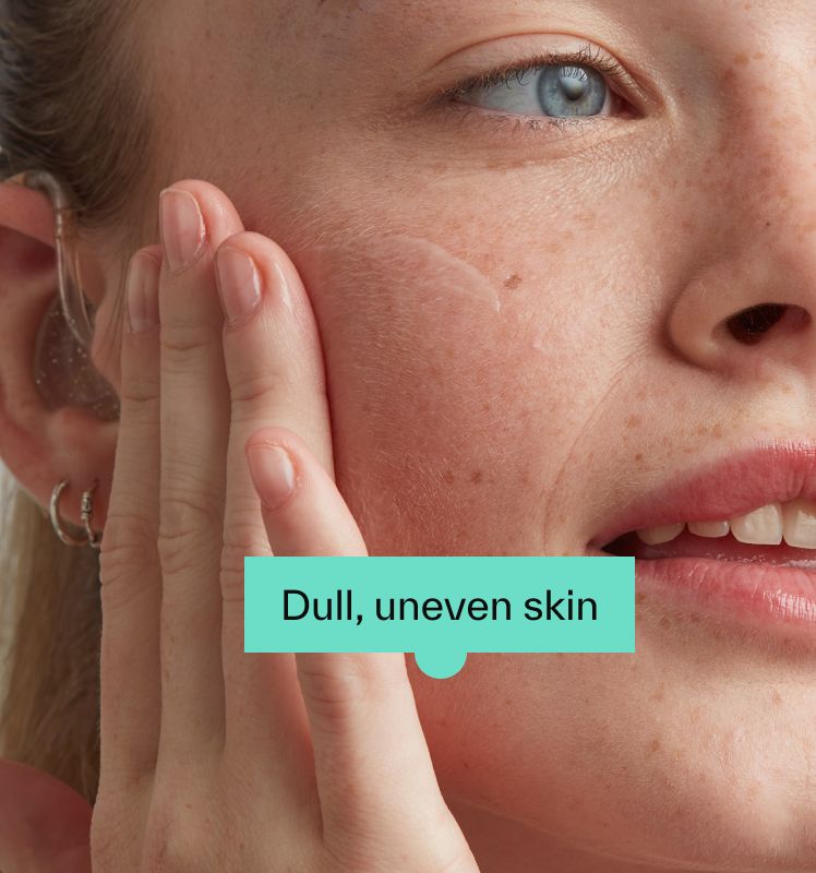 Dull, uneven skin